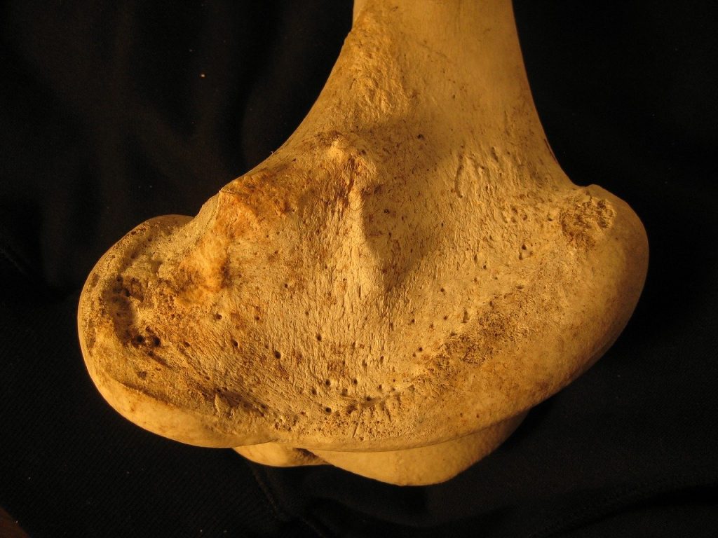 How to Ensure Stronger & Healthier Bone